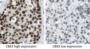 CBX gene fig 1.jpg