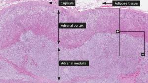 adrenal_gland__1__example_1__overview.jpg